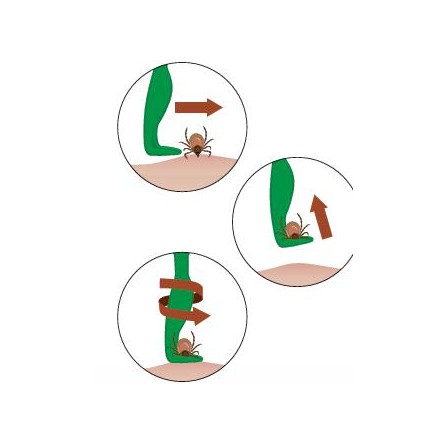 QUITAGARRAPATA 7 5CM